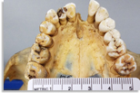teeth, photo courtesy of LaShanda Williams